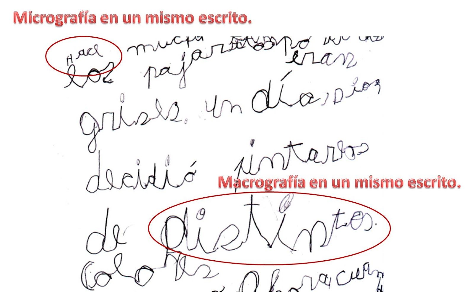 La escritura de los niños con déficit atencional.